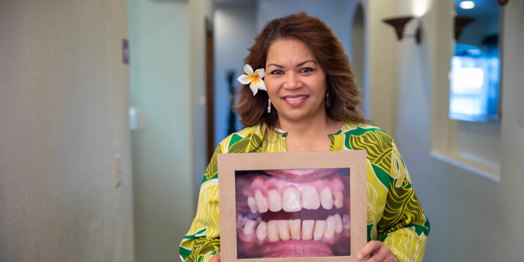 charlene with before photo after procedure