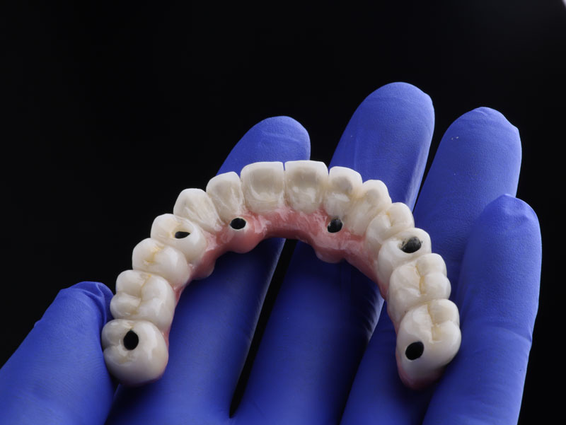 Photo dental implant work is completed and ready to use dental implant temporary abutment