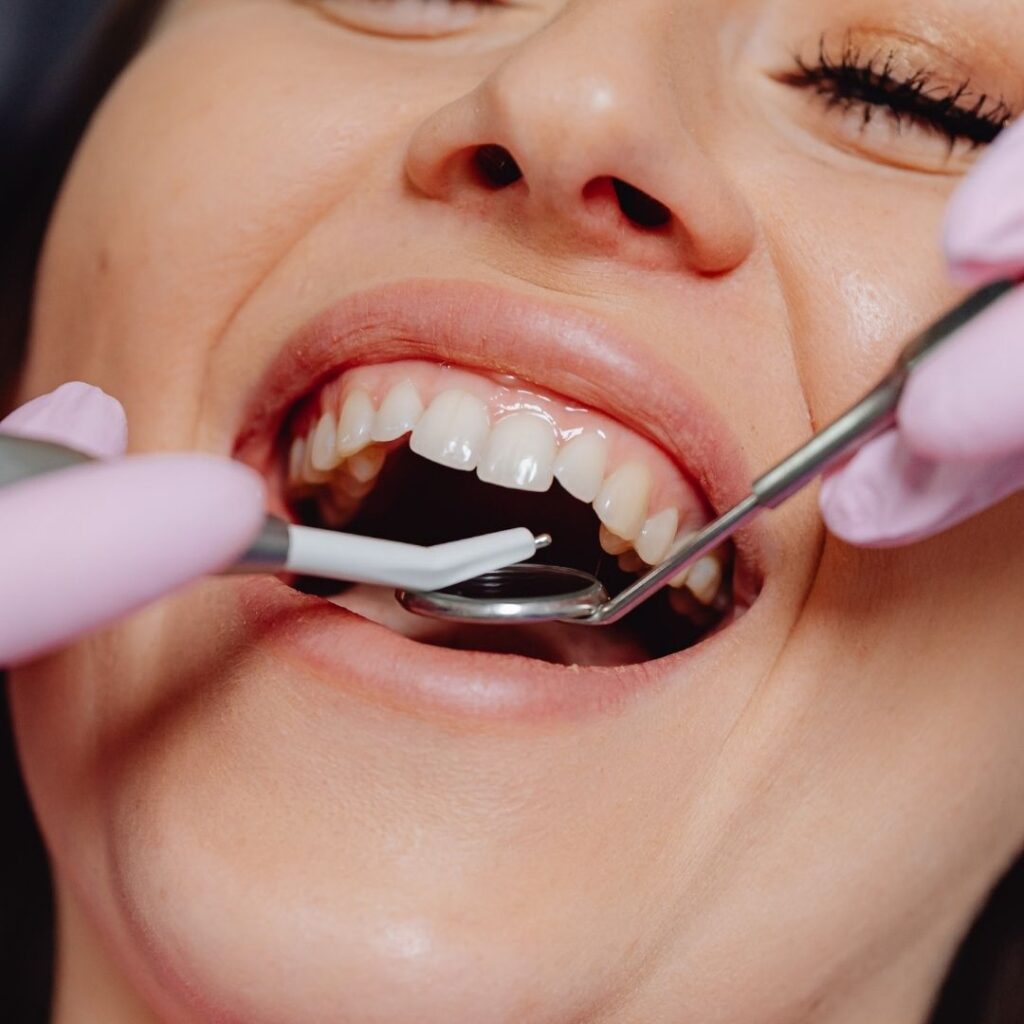 smiling woman having her teeth looked at by dentist