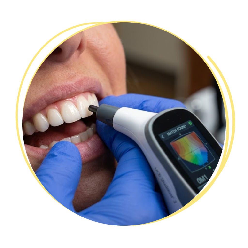 technology color matching to teeth